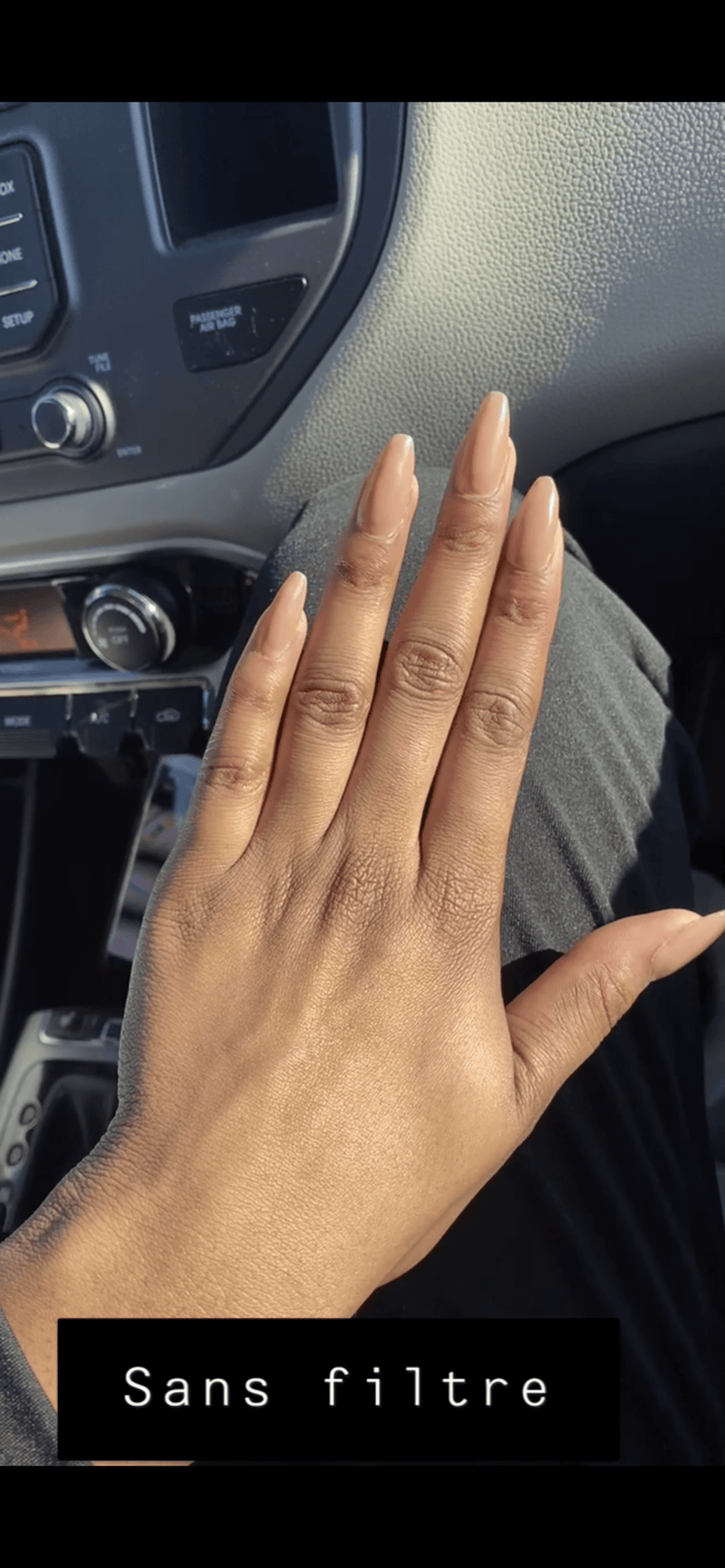 Correcteur de Zones Sombres